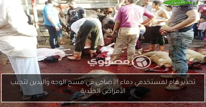 تحذير هام لمستخدمي دماء الأضاحي في مسح الوجه واليدين لتجنب الأمراض الجلدية