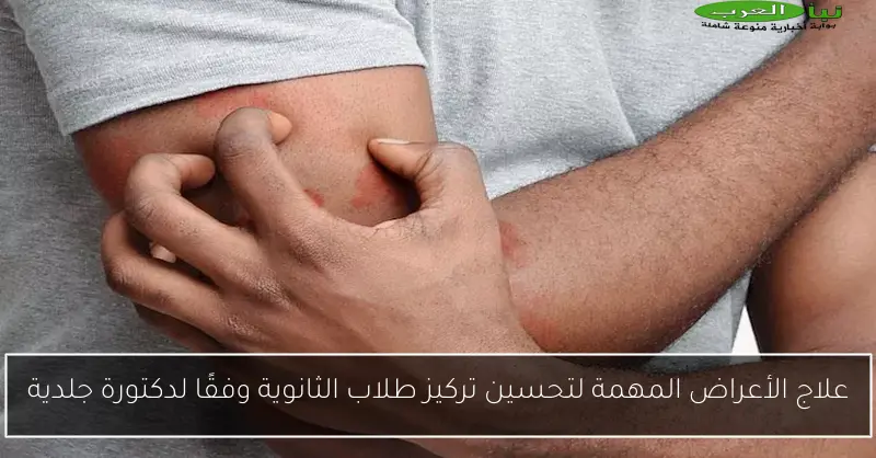 علاج الأعراض المهمة لتحسين تركيز طلاب الثانوية وفقًا لدكتورة جلدية