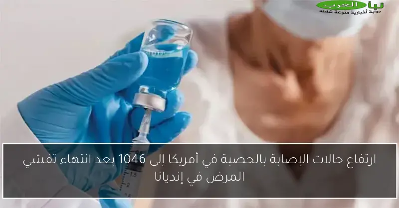 ارتفاع حالات الإصابة بالحصبة في أمريكا إلى 1046 بعد انتهاء تفشي المرض في إنديانا