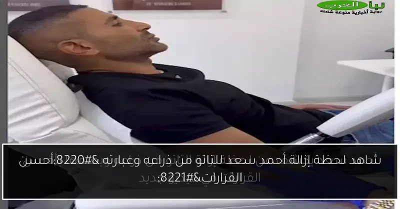 شاهد لحظة إزالة أحمد سعد للتاتو من ذراعه وعبارته “أحسن القرارات”