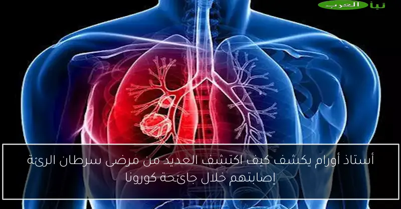 أستاذ أورام يكشف كيف اكتشف العديد من مرضى سرطان الرئة إصابتهم خلال جائحة كورونا