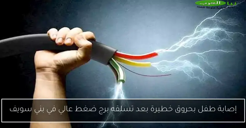 إصابة طفل بحروق خطيرة بعد تسلقه برج ضغط عالي في بني سويف