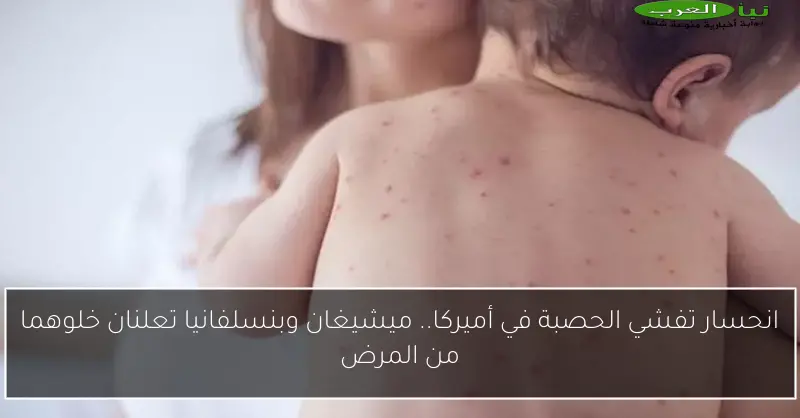 انحسار تفشي الحصبة في أميركا.. ميشيغان وبنسلفانيا تعلنان خلوهما من المرض
