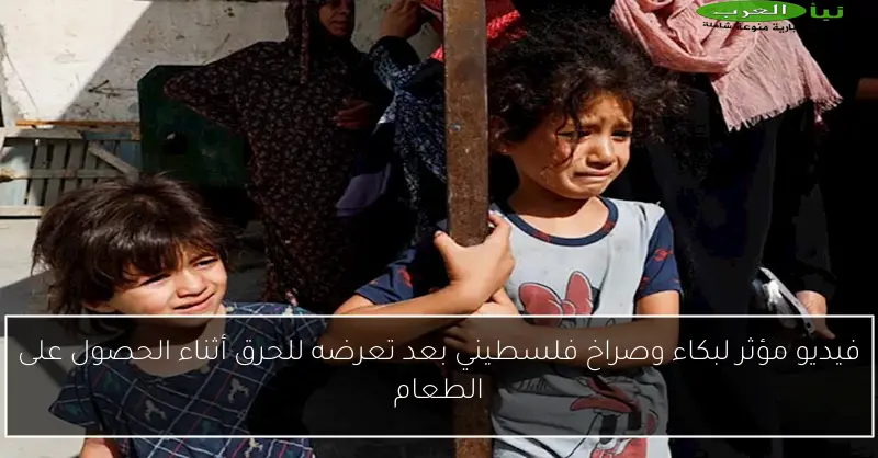 فيديو مؤثر لبكاء وصراخ فلسطيني بعد تعرضه للحرق أثناء الحصول على الطعام
