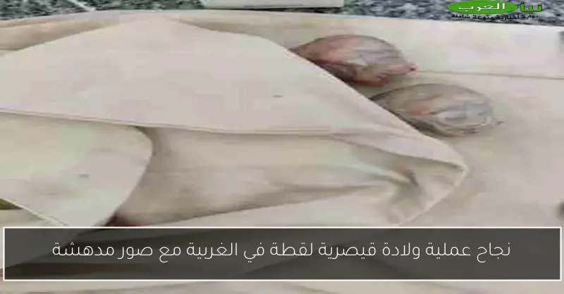 نجاح عملية ولادة قيصرية لقطة في الغربية مع صور مدهشة