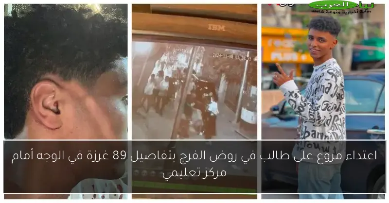اعتداء مروع على طالب في روض الفرج بتفاصيل 89 غرزة في الوجه أمام مركز تعليمي