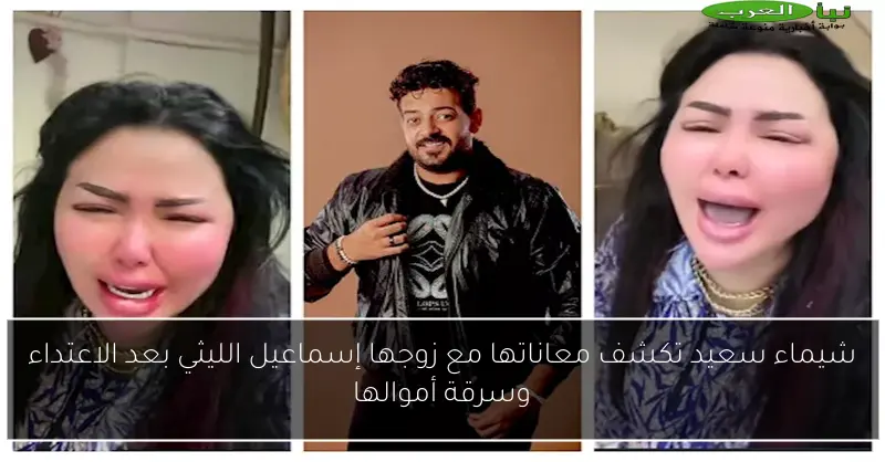 شيماء سعيد تكشف معاناتها مع زوجها إسماعيل الليثي بعد الاعتداء وسرقة أموالها
