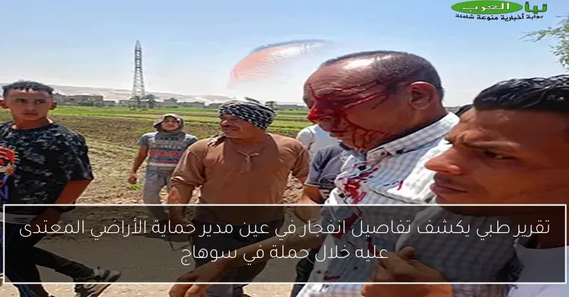 تقرير طبي يكشف تفاصيل انفجار في عين مدير حماية الأراضي المعتدى عليه خلال حملة في سوهاج