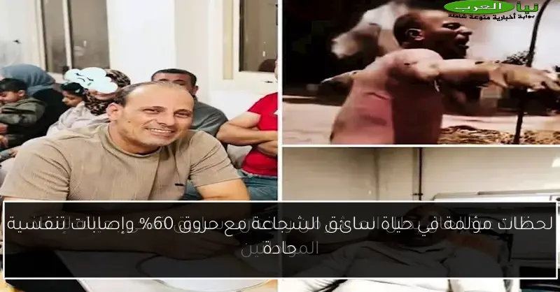 لحظات مؤلمة في حياة سائق الشجاعة مع حروق 60% وإصابات تنفسية حادة