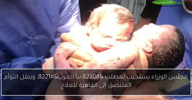 مجلس الوزراء يستجيب لمطلب “نبأ العرب” وينقل التوأم الملتصق إلى القاهرة للعلاج
