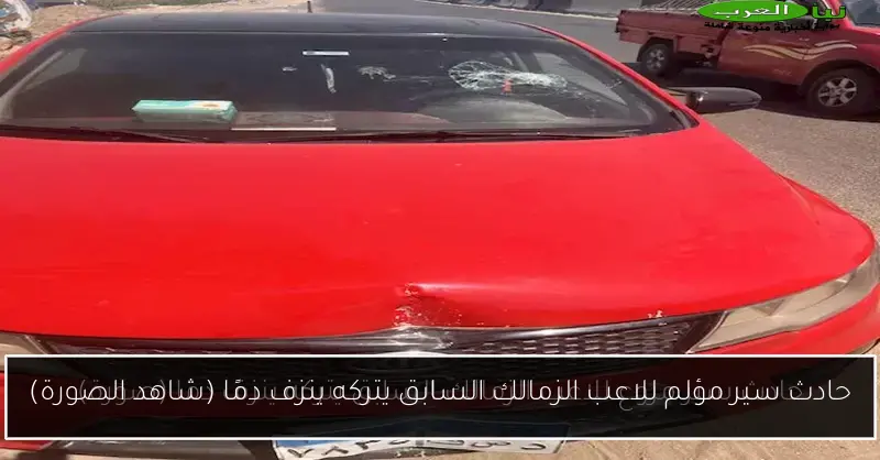 حادث سير مؤلم للاعب الزمالك السابق يتركه ينزف دمًا (شاهد الصورة)