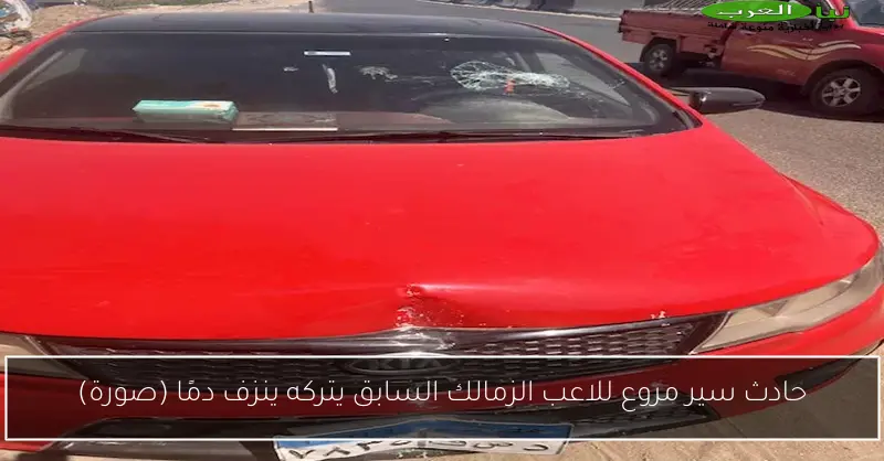 حادث سير مروع للاعب الزمالك السابق يتركه ينزف دمًا (صورة)