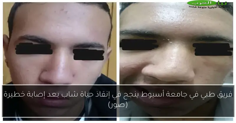 فريق طبي في جامعة أسيوط ينجح في إنقاذ حياة شاب بعد إصابة خطيرة (صور)
