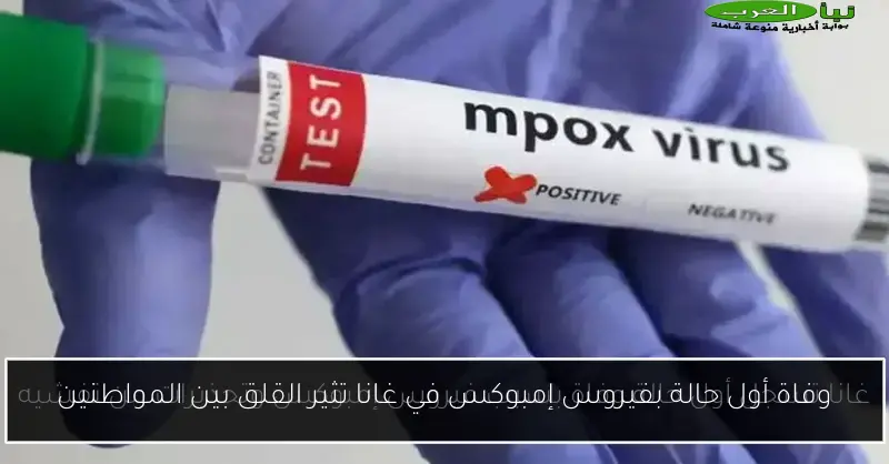 وفاة أول حالة بفيروس إمبوكس في غانا تثير القلق بين المواطنين