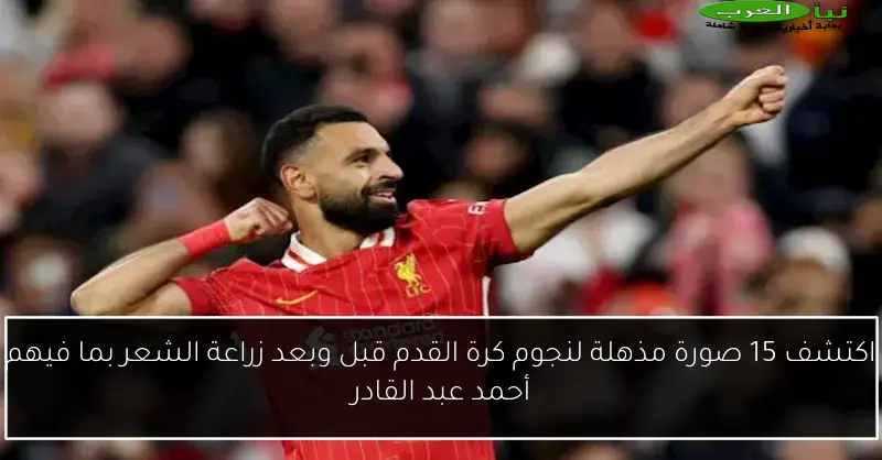 اكتشف 15 صورة مذهلة لنجوم كرة القدم قبل وبعد زراعة الشعر بما فيهم أحمد عبد القادر