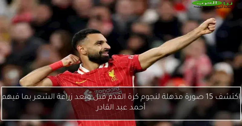 اكتشف 15 صورة مذهلة لنجوم كرة القدم قبل وبعد زراعة الشعر بما فيهم أحمد عبد القادر