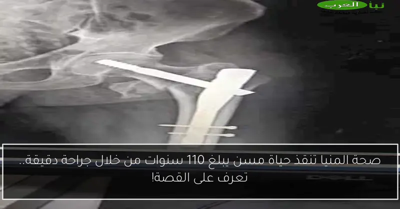 صحة المنيا تنقذ حياة مسن يبلغ 110 سنوات من خلال جراحة دقيقة.. تعرف على القصة!