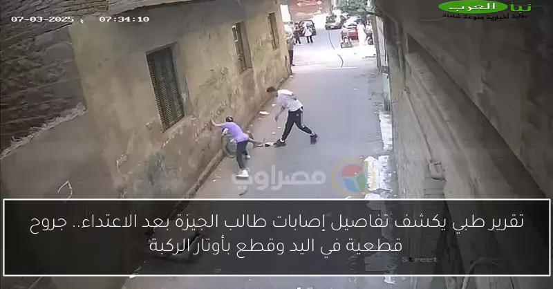 تقرير طبي يكشف تفاصيل إصابات طالب الجيزة بعد الاعتداء.. جروح قطعية في اليد وقطع بأوتار الركبة