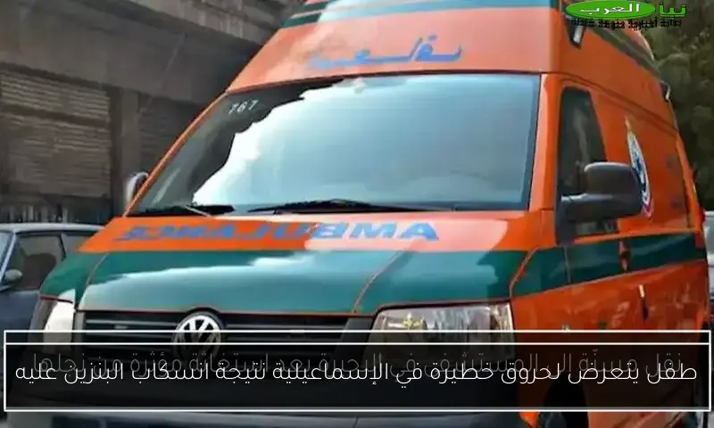 طفل يتعرض لحروق خطيرة في الإسماعيلية نتيجة انسكاب البنزين عليه