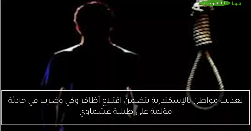تعذيب مواطن بالإسكندرية يتضمن اقتلاع أظافر وكي وضرب في حادثة مؤلمة على طبلية عشماوي