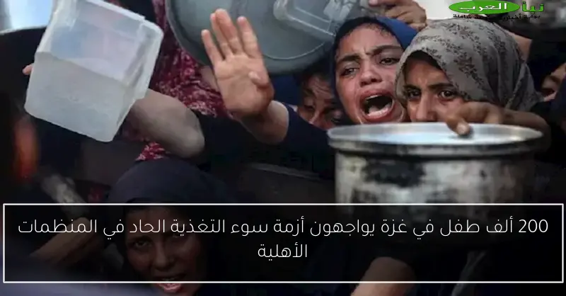 200 ألف طفل في غزة يواجهون أزمة سوء التغذية الحاد في المنظمات الأهلية
