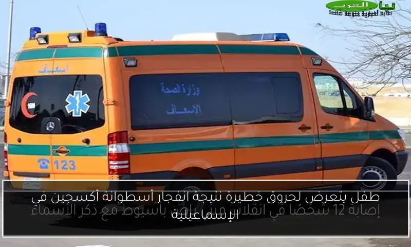 طفل يتعرض لحروق خطيرة نتيجة انفجار أسطوانة أكسجين في الإسماعيلية