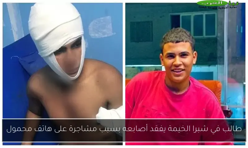 طالب في شبرا الخيمة يفقد أصابعه بسبب مشاجرة على هاتف محمول
