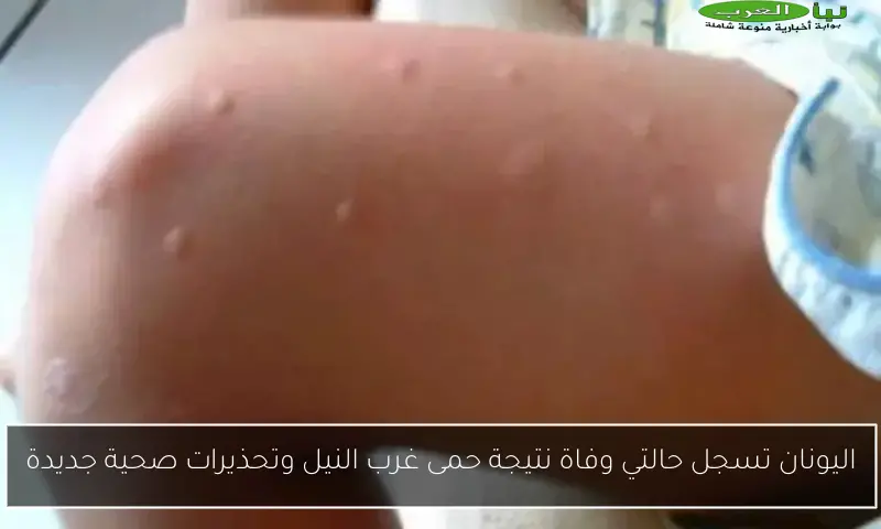 اليونان تسجل حالتي وفاة نتيجة حمى غرب النيل وتحذيرات صحية جديدة