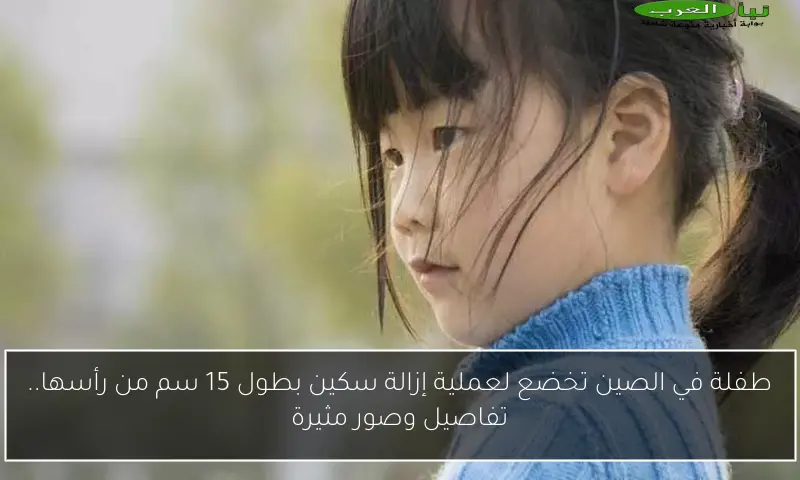 طفلة في الصين تخضع لعملية إزالة سكين بطول 15 سم من رأسها.. تفاصيل وصور مثيرة