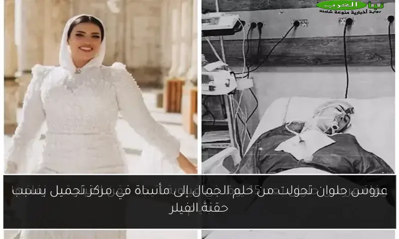 عروس حلوان تحولت من حلم الجمال إلى مأساة في مركز تجميل بسبب حقنة الفيلر