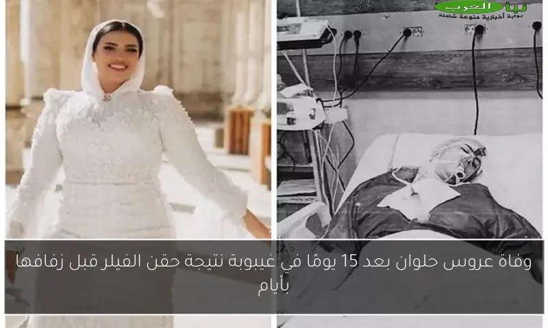 وفاة عروس حلوان بعد 15 يومًا في غيبوبة نتيجة حقن الفيلر قبل زفافها بأيام