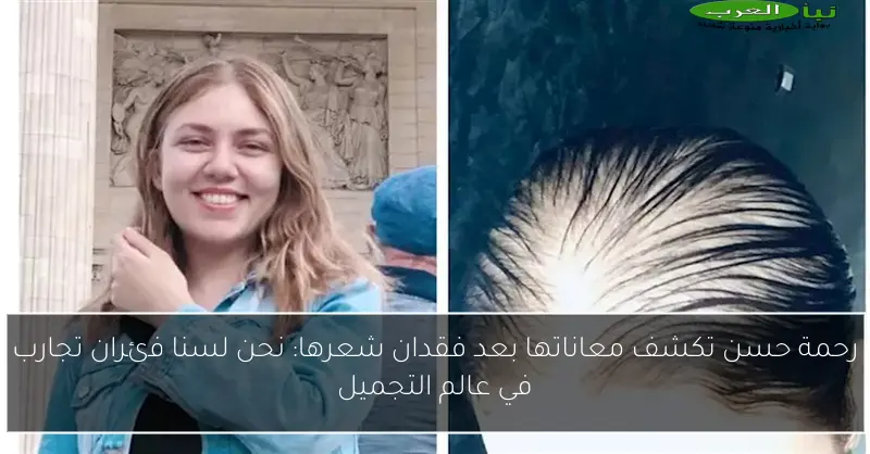 رحمة حسن تكشف معاناتها بعد فقدان شعرها: نحن لسنا فئران تجارب في عالم التجميل