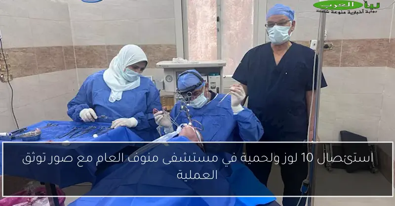 استئصال 10 لوز ولحمية في مستشفى منوف العام مع صور توثق العملية