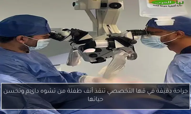 جراحة دقيقة في قها التخصصي تنقذ أنف طفلة من تشوه دائم وتحسن حياتها