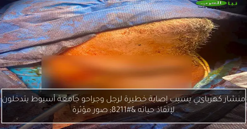 منشار كهربائي يسبب إصابة خطيرة لرجل وجراحو جامعة أسيوط يتدخلون لإنقاذ حياته – صور مؤثرة