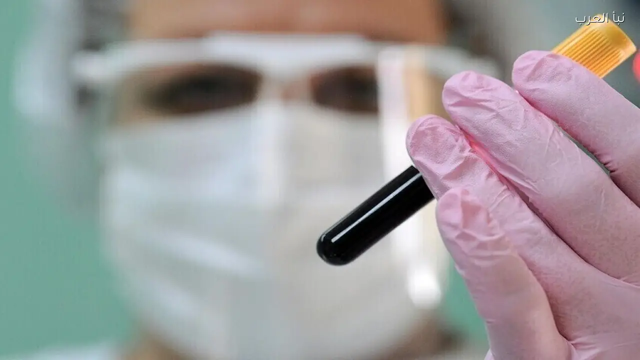 جدل منشأ كوفيد-19 يعود اليوم مع دراسة جديدة تكشف أصول الأوبئة