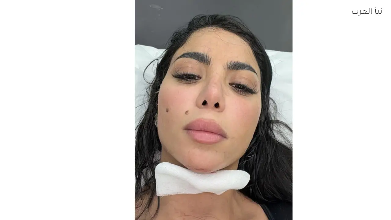 كارولين عزمي تعلق على تجربتها في “رامز ليفل الوحش” بعد وقوعها ضحية